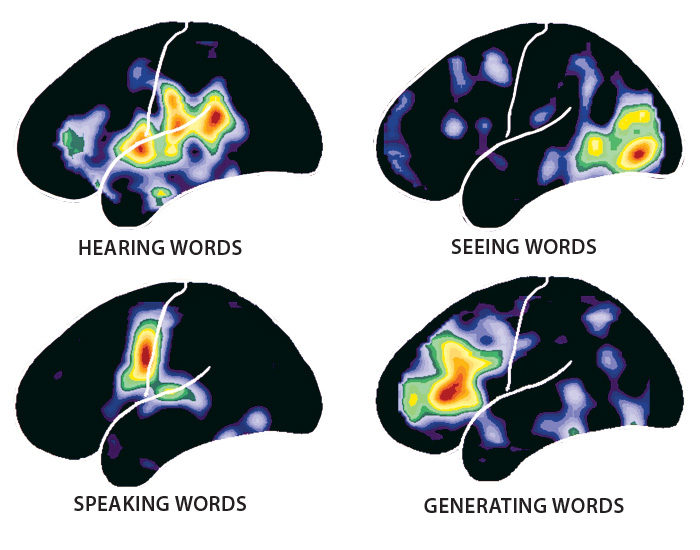 Pioneering neurologist explores the mind’s mysteries - Outlook Magazine