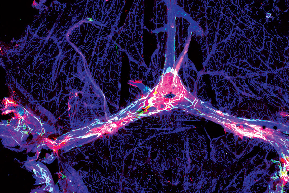 Photo of the central nervous system. 